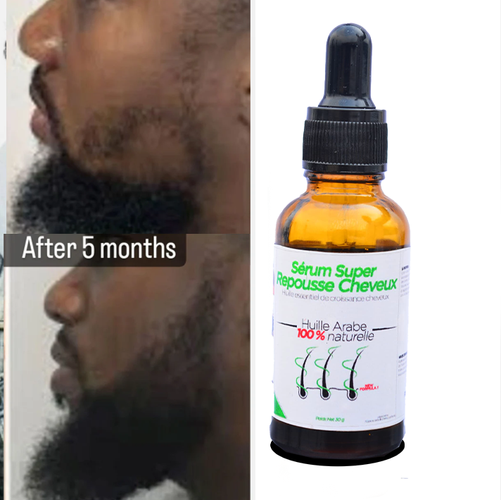 Sérum ARABE - Croissance Barbe Original™