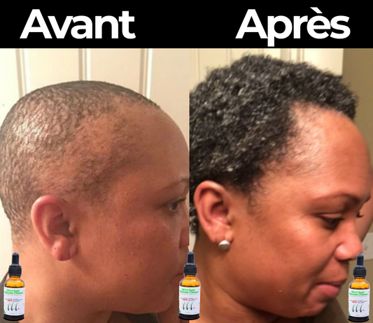 Sérum Super Repousse Cheveux  ARABE Original™