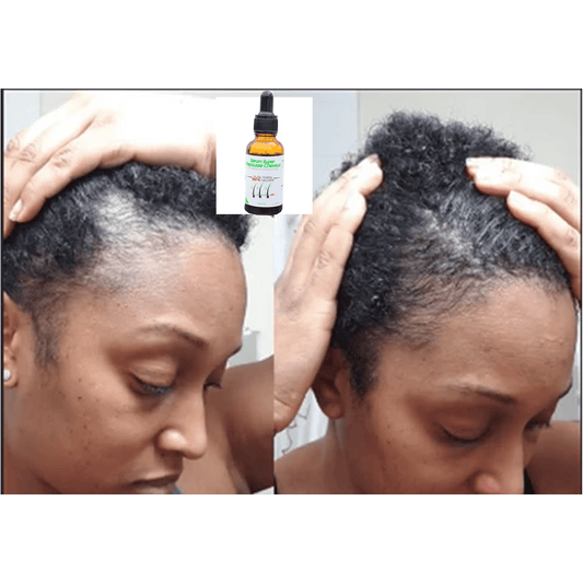 Sérum Super Repousse Cheveux ARABE Original™ - NJ Market